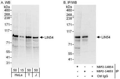 Immunoprecipitation: lin-54 Antibody [NBP2-14854]