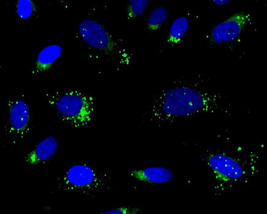 LipoLIVE™ Green Non-Toxic Dye Application