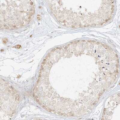 Immunohistochemistry-Paraffin: lipoyltransferase 1 Antibody [NBP1-92073]
