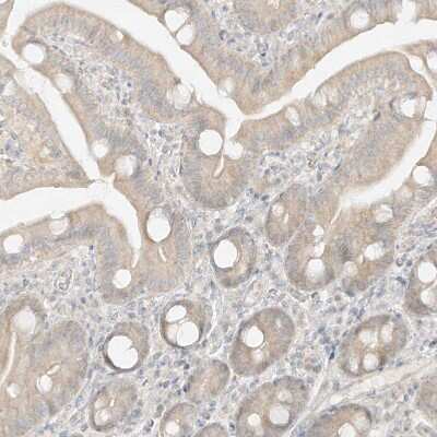 Immunohistochemistry-Paraffin: lipoyltransferase 1 Antibody [NBP1-92073]