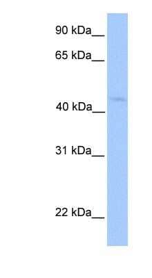 Western Blot: lipoyltransferase 1 Antibody [NBP1-54912]