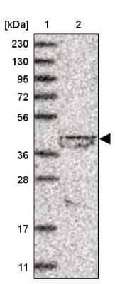 Western Blot: lipoyltransferase 1 Antibody [NBP1-92073]