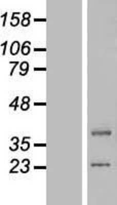 Western Blot: lipoyltransferase 1 Overexpression Lysate [NBL1-12553]