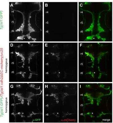 Immunohistochemistry: mCherry Antibody (1C51) [NBP1-96752]