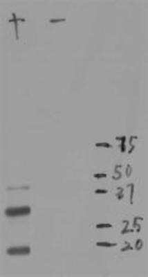 Western Blot: mCherry Antibody (1C51) [NBP1-96752]