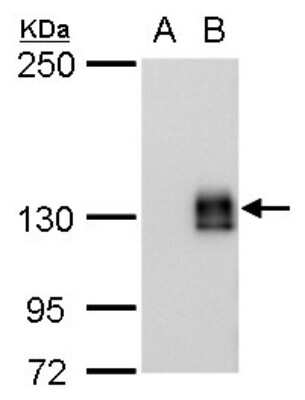 Western Blot: mCherry Antibody (235) [NBP2-43768]