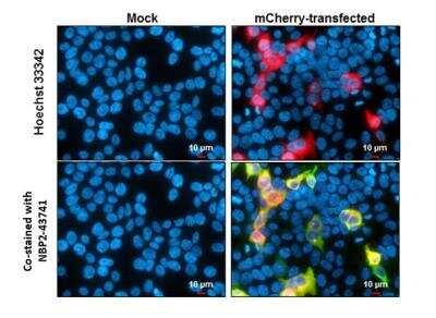 Immunocytochemistry/ Immunofluorescence: mCherry Antibody (844) [NBP2-43778]