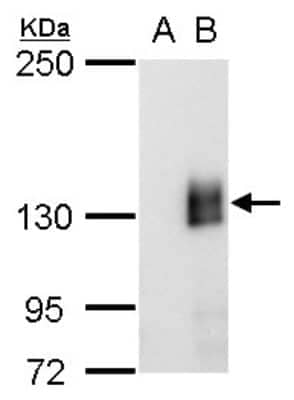 Western Blot: mCherry Antibody (857) [NBP2-43769]