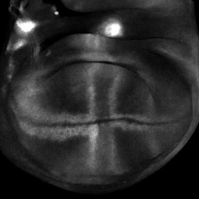 Fluorescence Imaging: mCherry Antibody [NBP2-25157]