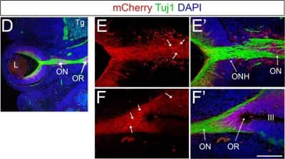 Immunohistochemistry: mCherry Antibody [NBP2-25157]