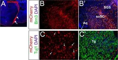 Immunocytochemistry/ Immunofluorescence: mCherry Antibody [NBP2-25157]