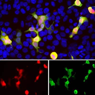 Immunocytochemistry/ Immunofluorescence: mCherry Antibody [NBP2-25158]