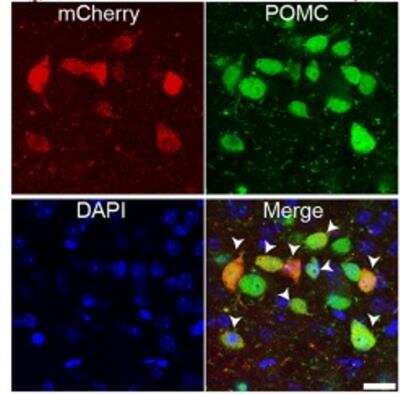 Immunohistochemistry: mCherry Antibody [NBP2-25157]