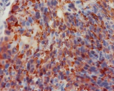 Immunohistochemistry-Paraffin: mCherry Antibody [NBP2-25157]