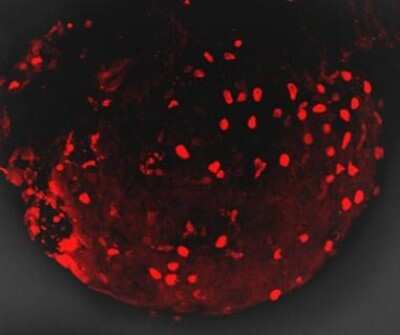 Immunohistochemistry Whole-Mount: mCherry Antibody [NBP2-43720]