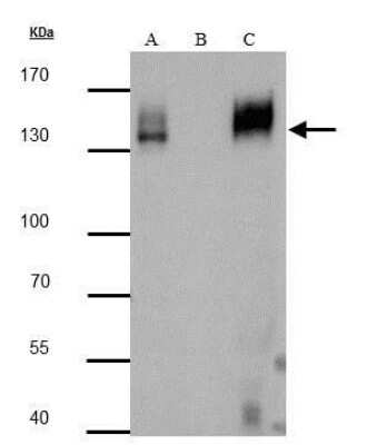 Immunoprecipitation: mCherry Antibody [NBP2-43720]
