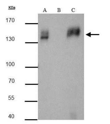 Immunoprecipitation: mCherry Antibody [NBP2-43727]