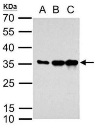 Western Blot: mCherry Antibody [NBP2-43720]