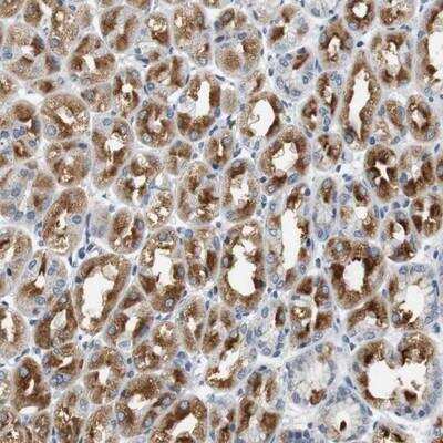 Immunohistochemistry-Paraffin: mGluR1 Antibody [NBP1-89736]