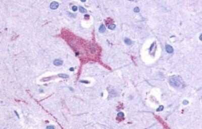 Immunohistochemistry-Paraffin: mGluR1 Antibody - BSA Free [NLS882]