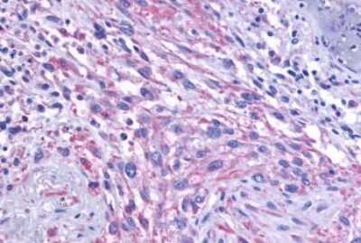 Immunohistochemistry-Paraffin: mGluR1 Antibody - BSA Free [NLS882]