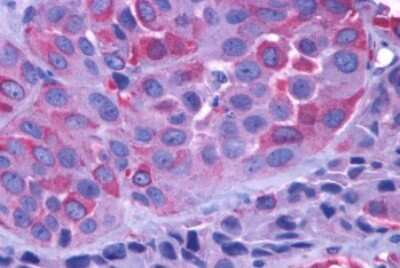 Immunohistochemistry-Paraffin: mGluR1 Antibody - BSA Free [NLS882]