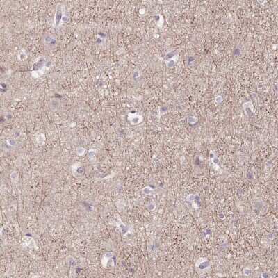 Immunohistochemistry: mGluR2 Antibody [NBP2-49436]