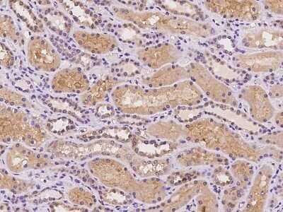 Immunohistochemistry-Paraffin: mGluR2 Antibody [NBP2-97220]