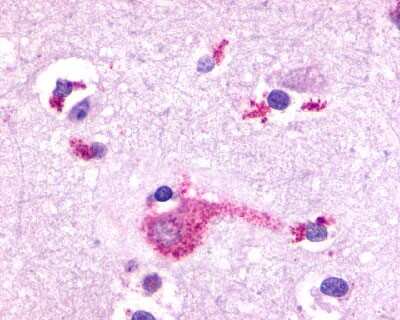Immunohistochemistry-Paraffin: mGluR2 Antibody - BSA Free [NLS892]
