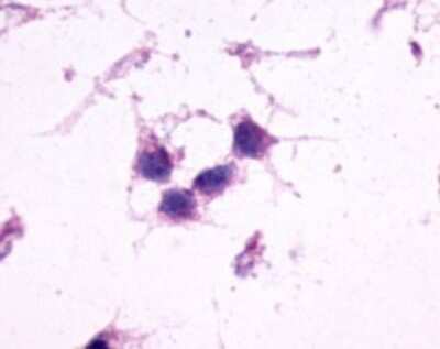 Immunohistochemistry-Paraffin: mGluR2 Antibody - BSA Free [NLS892]