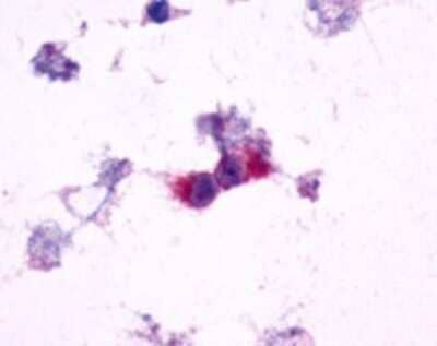 Immunohistochemistry-Paraffin: mGluR2 Antibody - BSA Free [NLS892]