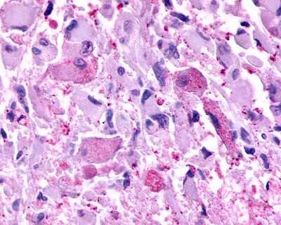 Immunohistochemistry-Paraffin: mGluR2 Antibody - BSA Free [NLS892]