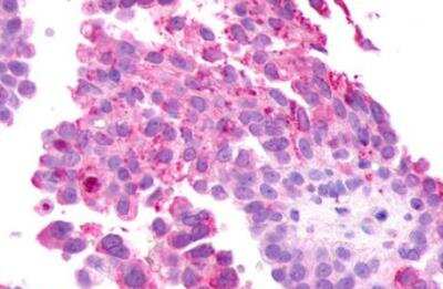 Immunohistochemistry-Paraffin: mGluR2 Antibody - BSA Free [NLS892]