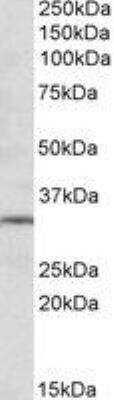 Western Blot: mGluR2 Antibody [NBP1-68855]