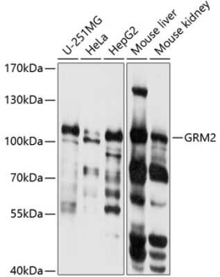 Western Blot: mGluR2 AntibodyBSA Free [NBP3-03722]