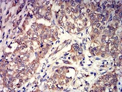 Immunohistochemistry: mGluR3 Antibody (6H10C3) - BSA Free [NBP2-61842]