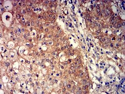 Immunohistochemistry: mGluR3 Antibody (6H10C3) - BSA Free [NBP2-61842]