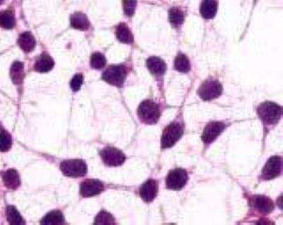 Immunocytochemistry/ Immunofluorescence: mGluR3 Antibody - BSA Free [NLS3218]