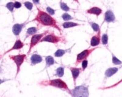 Immunohistochemistry-Paraffin: mGluR3 Antibody - BSA Free [NLS3208]