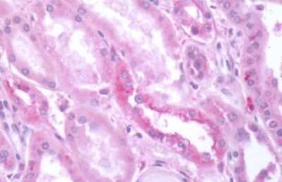 Immunohistochemistry-Paraffin: mGluR3 Antibody - BSA Free [NLS3208]