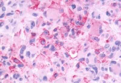 Immunohistochemistry-Paraffin: mGluR3 Antibody - BSA Free [NLS3208]