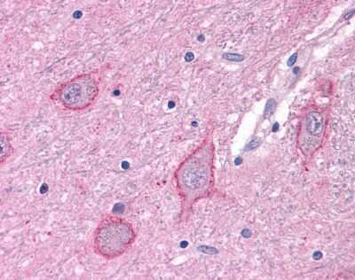 Immunohistochemistry-Paraffin: mGluR3 Antibody - BSA Free [NLS3218]