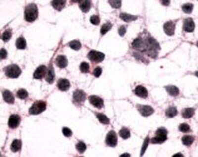 Immunohistochemistry-Paraffin: mGluR3 Antibody - BSA Free [NLS899]