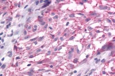 Immunohistochemistry-Paraffin: mGluR3 Antibody - BSA Free [NLS899]