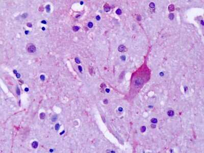 Immunohistochemistry-Paraffin: mGluR4 Antibody - BSA Free [NLS4713]