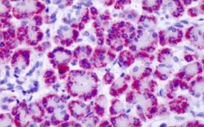 Immunohistochemistry-Paraffin: mGluR4 Antibody - BSA Free [NLS4713]