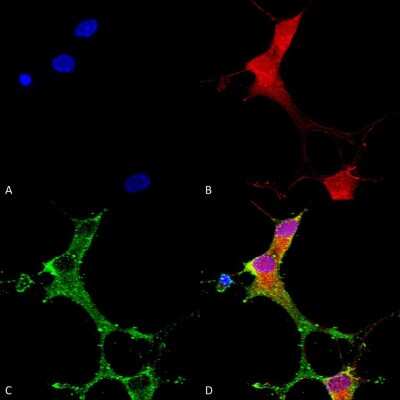 Immunocytochemistry/ Immunofluorescence: mGluR5/1 Antibody (S75-3) [NBP2-22424]