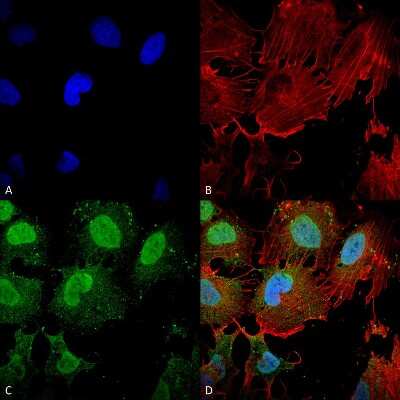 Immunocytochemistry/ Immunofluorescence: mGluR5/1 Antibody (S75-3) [NBP2-22424]