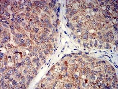 Immunohistochemistry: mGluR5 Antibody (1A11D10) - BSA Free [NBP2-61828]