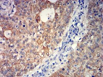 Immunohistochemistry: mGluR5 Antibody (1A11D10) - BSA Free [NBP2-61828]